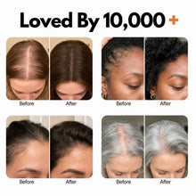YORVENA™ Korean Hair Growth & Scalp Care Serum
