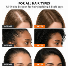 YORVENA™ Korean Hair Growth & Scalp Care Serum